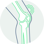 Injured Knee From Sprain, Strain, or Tear